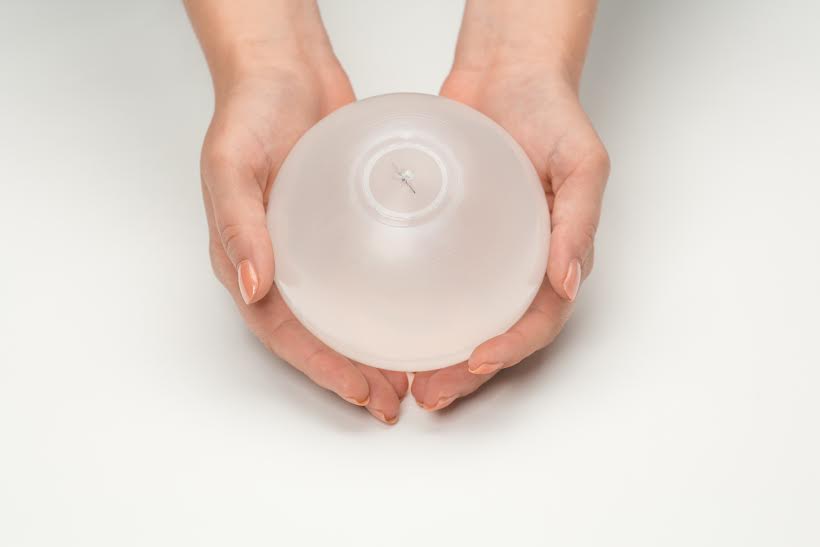 placement of the gastric balloon